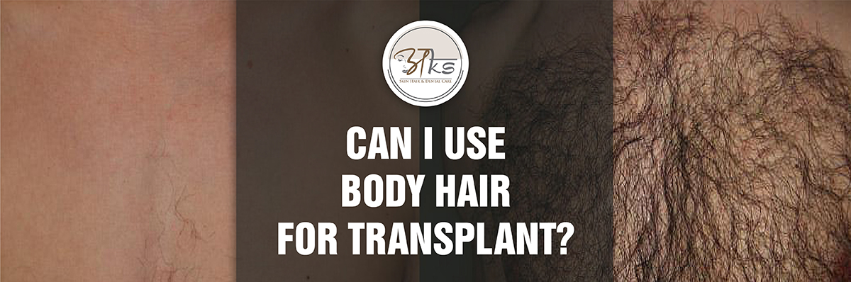 Post Hair Transplant Procedures